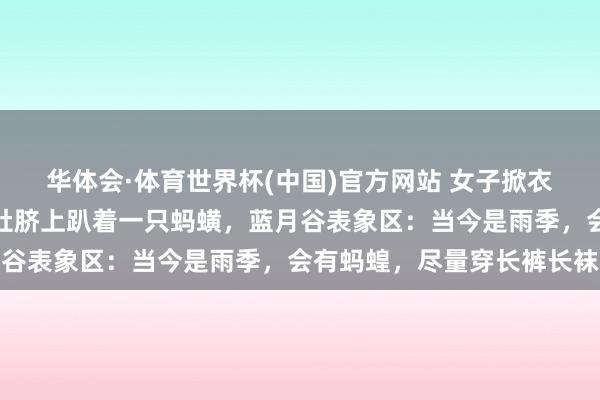 华体会·体育世界杯(中国)官方网站 女子掀衣着思露腰拍照时，发现肚脐上趴着一只蚂蟥，